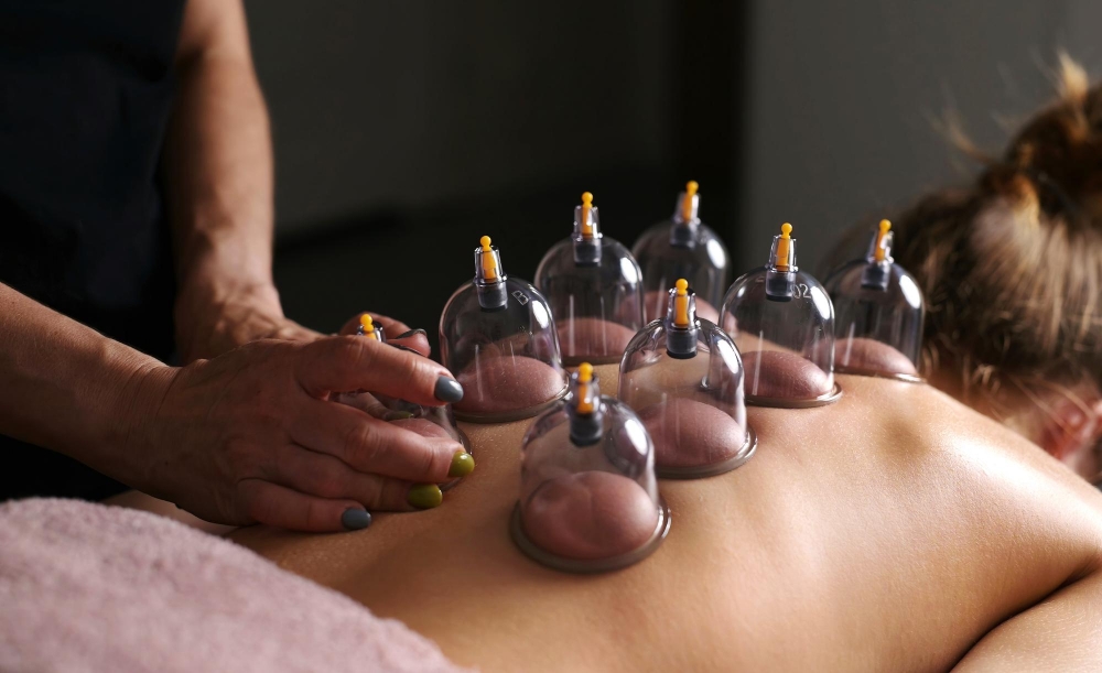 Cupping Therapy